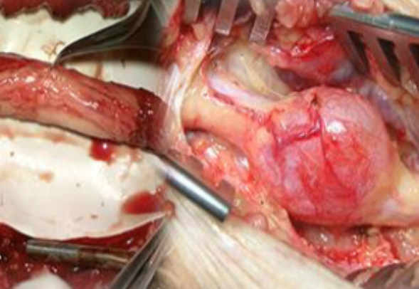 Kurz chirurgie periferních nervů